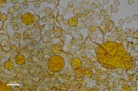 Attēlu rezultāti vaicājumam “Hemitrichia sordivesiculosa macro”