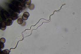 Attēlu rezultāti vaicājumam “Diderma subviridifuscum sessile”