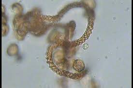 Attēlu rezultāti vaicājumam “Lycogala confusum young”