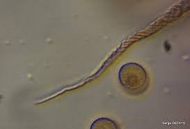 Attēlu rezultāti vaicājumam “Trichia ambigua”