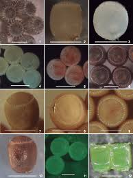 Attēlu rezultāti vaicājumam “Pentatomidae eggs”