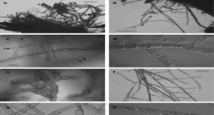 Attēlu rezultāti vaicājumam “Homomallium incurvatum sporophyte”