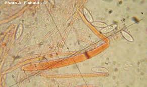 Attēlu rezultāti vaicājumam “Hymenoscyphus calyculus”