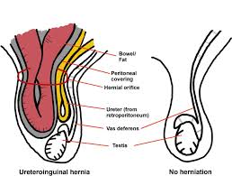 Image result for Heanor Sac