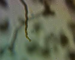 Attēlu rezultāti vaicājumam “Trichia contorta spores”