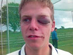 Image result for Shireshead and Forton Cc