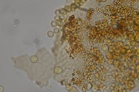 Attēlu rezultāti vaicājumam “Hemitrichia sordivesiculosa macro”