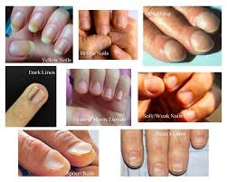 Image result for lunula nail