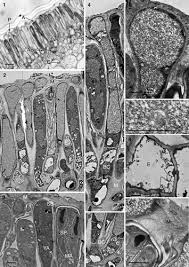 Attēlu rezultāti vaicājumam “Orbilia sp.”