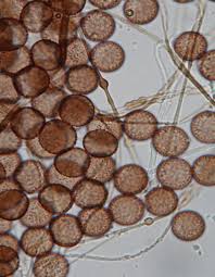 Attēlu rezultāti vaicājumam “Diderma globosum sessile”