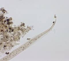 Attēlu rezultāti vaicājumam “Metatrichia floriformis stalked”