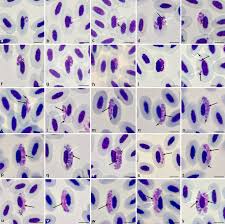 Attēlu rezultāti vaicājumam “Siphoptychium violaceum plasmodium”