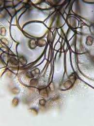 Attēlu rezultāti vaicājumam “Lamproderma gulielmae spores”