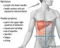 Hepatitis C, The University Hospital, Newark, New Jerse