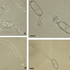 Attēlu rezultāti vaicājumam “Sawadaea tulasnei”
