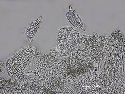 Attēlu rezultāti vaicājumam “Phlyctis agelaea”