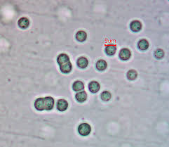 Attēlu rezultāti vaicājumam “Heterotrichia oerstedii (syn. Arcyria oerstedii) stalked”