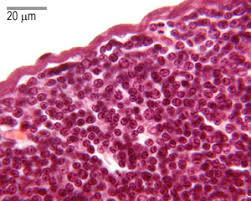 Image result for Thymus