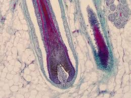 Image result for human hair microscope image