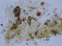 Attēlu rezultāti vaicājumam “Licea minima spores”