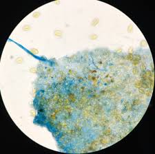 Attēlu rezultāti vaicājumam “Metatrichia floriformis stalked”