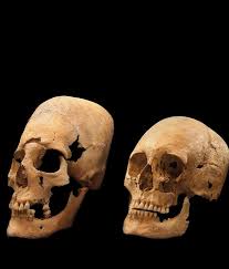 Image result for elongated skulls