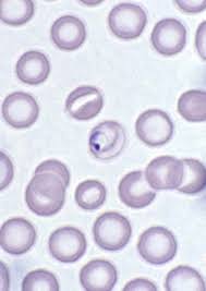 Attēlu rezultāti vaicājumam “Diderma umbilicatum plasmodium”