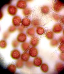 Attēlu rezultāti vaicājumam “Lycogala ustulatum”