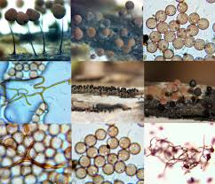 Attēlu rezultāti vaicājumam “Comatricha alta spores”