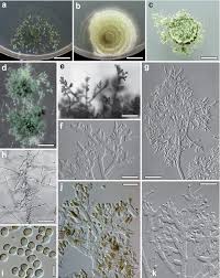 Attēlu rezultāti vaicājumam “Heterotrichia oerstedii (syn. Arcyria oerstedii) spores”