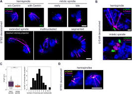 Attēlu rezultāti vaicājumam “undetermined plasmodium”