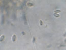 Attēlu rezultāti vaicājumam “Cudoniella clavus”