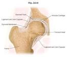 Illustration of a <b>hip joint</b>