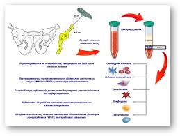 Image result for BMAC