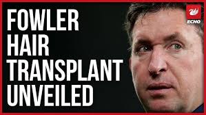 Image result for Liverpool Transplant FC