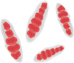 Attēlu rezultāti vaicājumam “Trichia contorta macro”