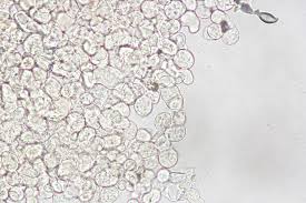 Attēlu rezultāti vaicājumam “Erythricium aurantiacum”