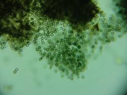 Attēlu rezultāti vaicājumam “Lichenoconium xanthoriae”