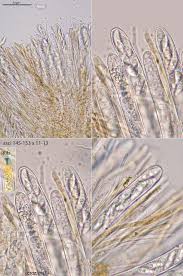 Attēlu rezultāti vaicājumam “Rutstroemia firma”