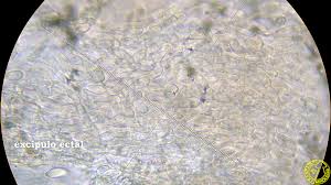 Attēlu rezultāti vaicājumam “Cudoniella acicularis”