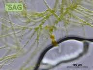 Attēlu rezultāti vaicājumam “Trentepohlia sp.”