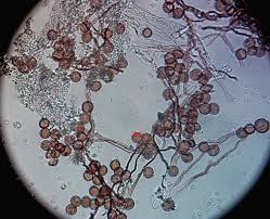 Attēlu rezultāti vaicājumam “Diderma crustaceum macro”