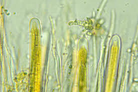 Attēlu rezultāti vaicājumam “Stictis”