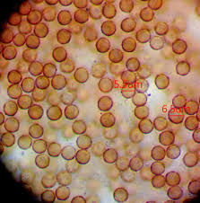 Attēlu rezultāti vaicājumam “Comatricha meandrispora macro”