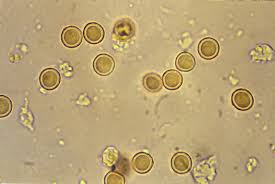 Attēlu rezultāti vaicājumam “Licea minima spores”