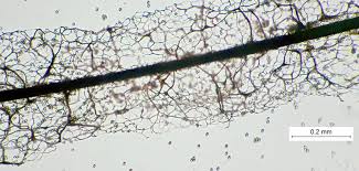Attēlu rezultāti vaicājumam “Stemonitis axifera spores”