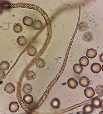 Attēlu rezultāti vaicājumam “Lycogala cf. oleocrystalliferum”