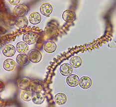 Attēlu rezultāti vaicājumam “Arcyria affinis spores”