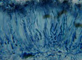 Attēlu rezultāti vaicājumam “Cliostomum corrugatum”