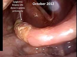 Attēlu rezultāti vaicājumam “Pemphigus borealis”